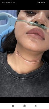 Warga Delima Nyaris Tewas Akibat Kabel Wifi Sembraut di Pekanbaru