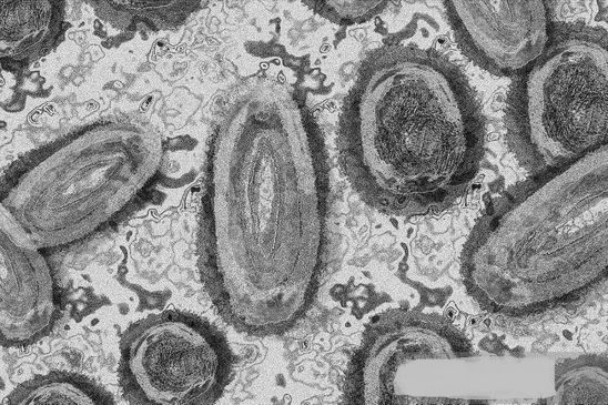 WHO Setujui Uji Diagnostik Mpox Pertama