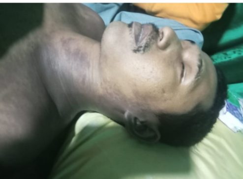 Lapas Kelas II A Sibolga Diduga Sembunyikan Kematian Tahanan