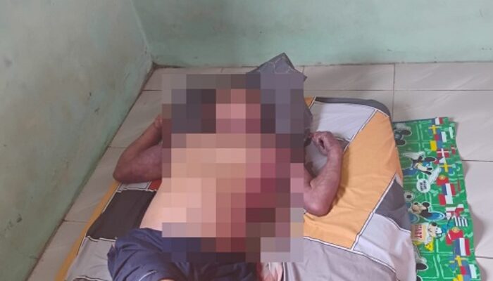 Di gegerkan Penemuan Mayat di Homestay Abel Kota Sibolga
