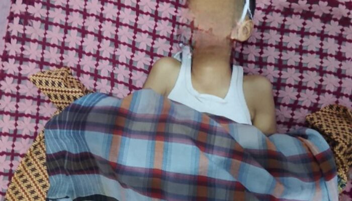 Diduga Jadi Korban Bully Parah, Murid SD di Pekanbaru Meninggal Dunia, Kuasa Hukum Tuntut Evaluasi Sekolah