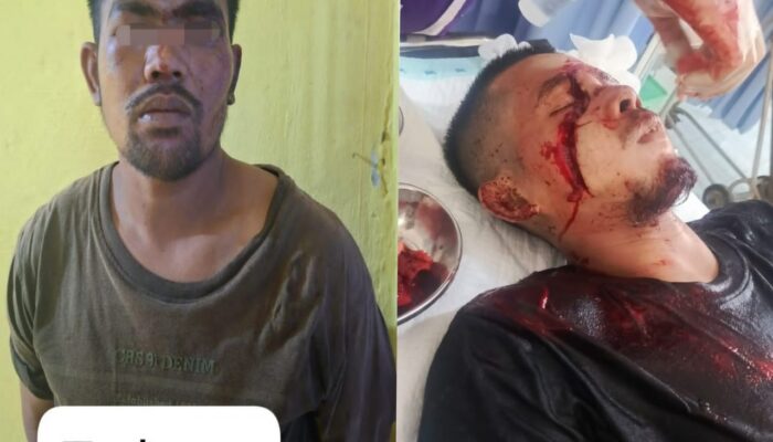 Pria di Kecamatan Batang Gansal Ini Bacok Wajah Pemuda, Ini Penyebabnya